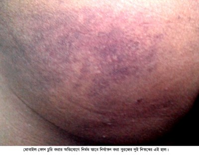 আদমদীঘিতে মোবাইল চুরির অভিযোগে প্রতিবন্ধী যুবককে নির্যাতন আদমদীঘিতে মোবাইল চুরির অভিযোগে প্রতিবন্ধী যুবককে নির্যাতন
